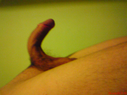 Penis ohnutý smerom na dol pri erekcii