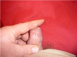 Hrčka na penise dlhá 1 cm